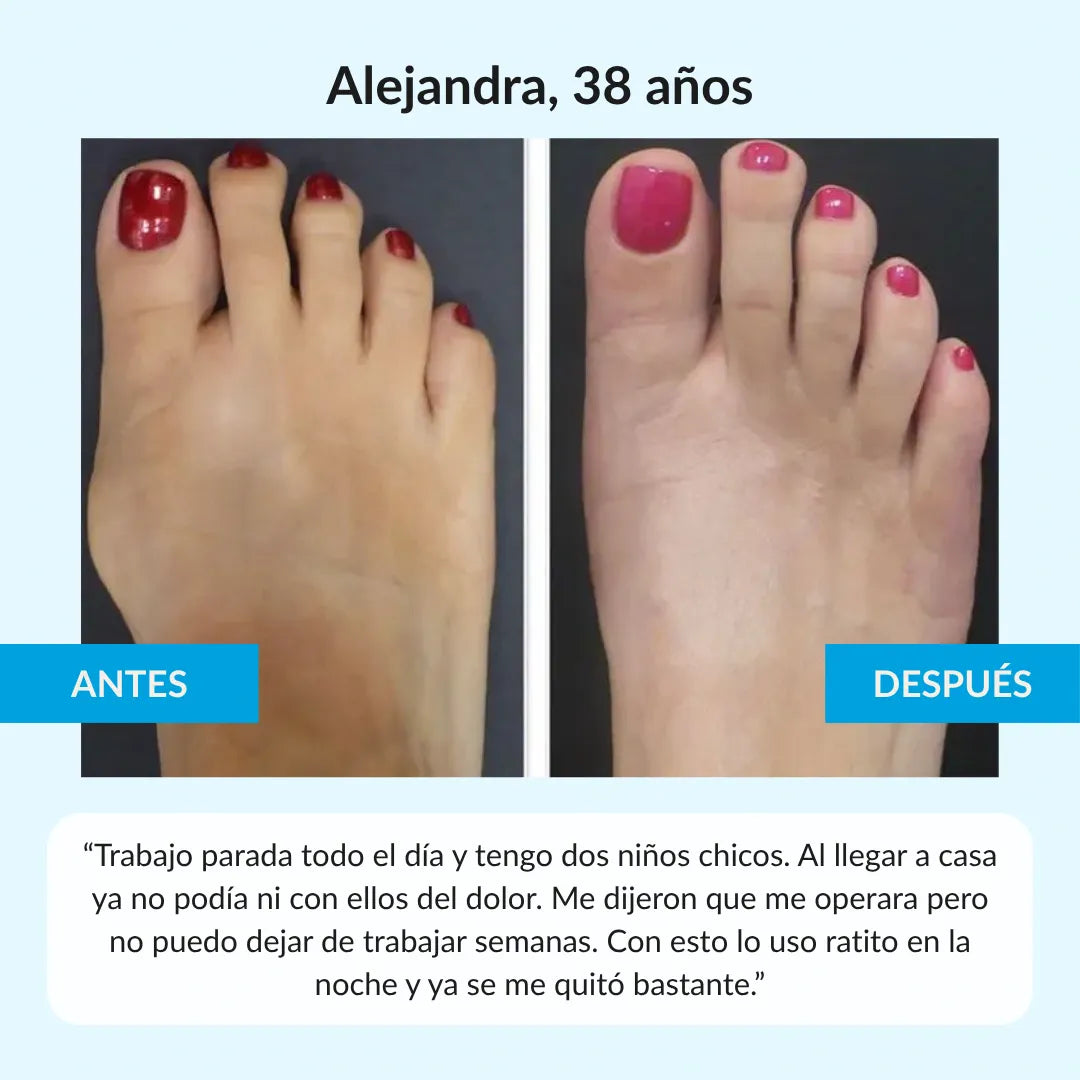 Nuleri™ - Corrector de Juanetes