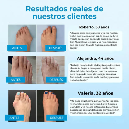 Nuleri™ - Corrector de Juanetes